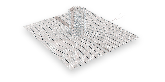 Parastomal hernias and how to prevent them